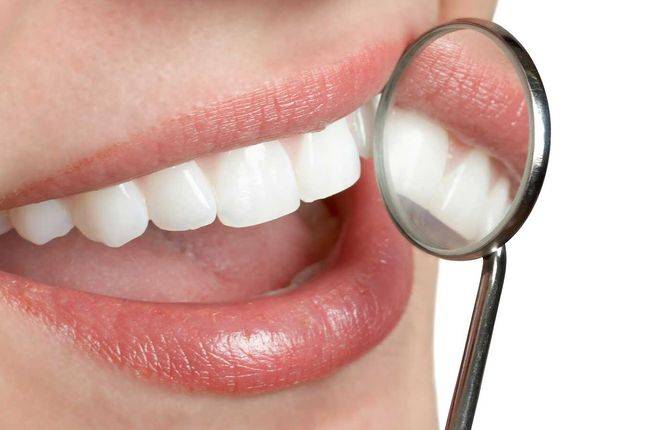 Teeth Whitening service image