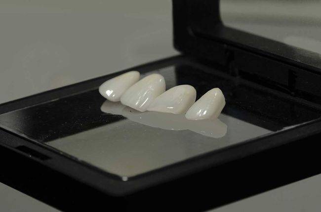 Dental Veneers service image